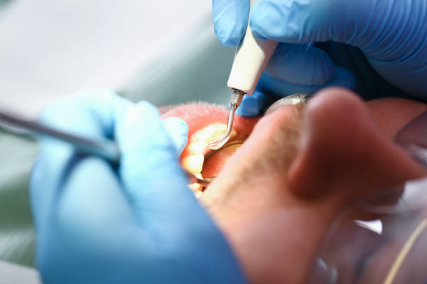 Best Weekend Emergency Dentist in Cresson, TX