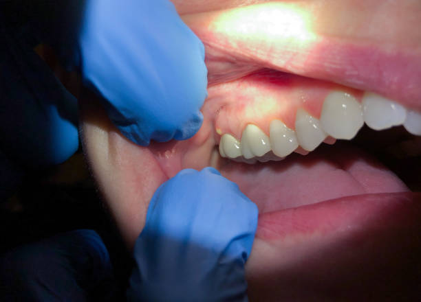 Best Orthodontic Emergency Dentist in Cresson, TX